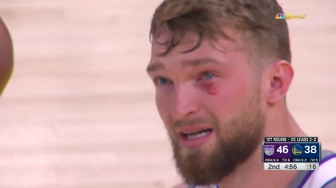 Sabonis vėl liko sužeistas, tačiau &bdquo;Kings&ldquo; i&scaron;lygino serijos rezultatą