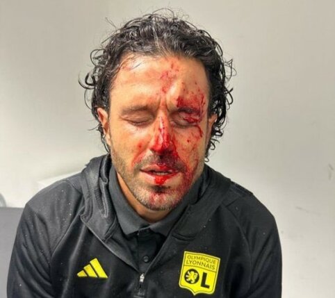 Prancūzijoje &ndash; &bdquo;Marseille&ldquo; fanų i&scaron;puolis prie&scaron; &bdquo;Lyon&ldquo; komandos autobusą