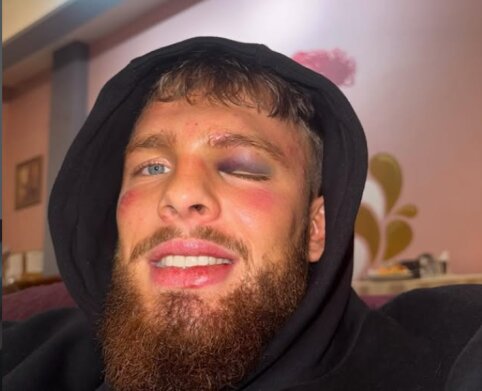 Sužalotas, bet nenugalėtas: D. Dirkstys Latvijoje pasiekė pergalę prie&scaron; boksininką